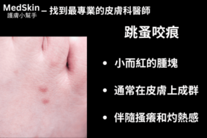 跳蚤咬痕