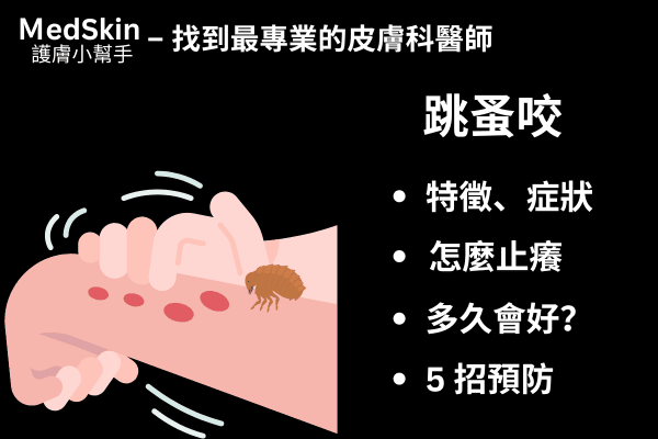 跳蚤咬特徵