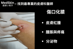 傷口化膿